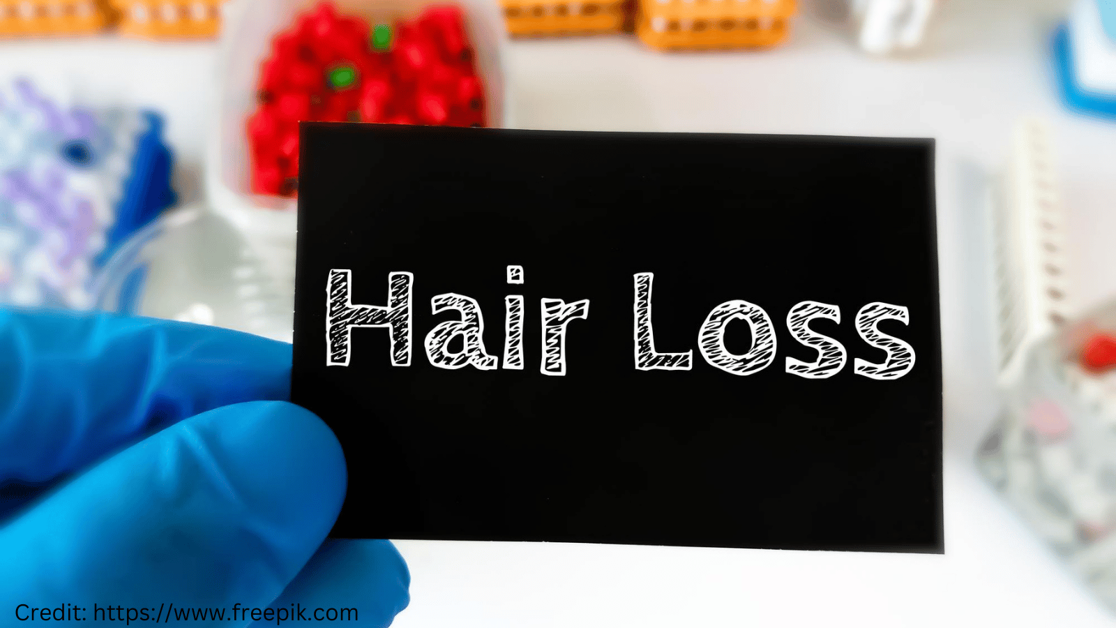 Can Diabetes Cause Hair Loss